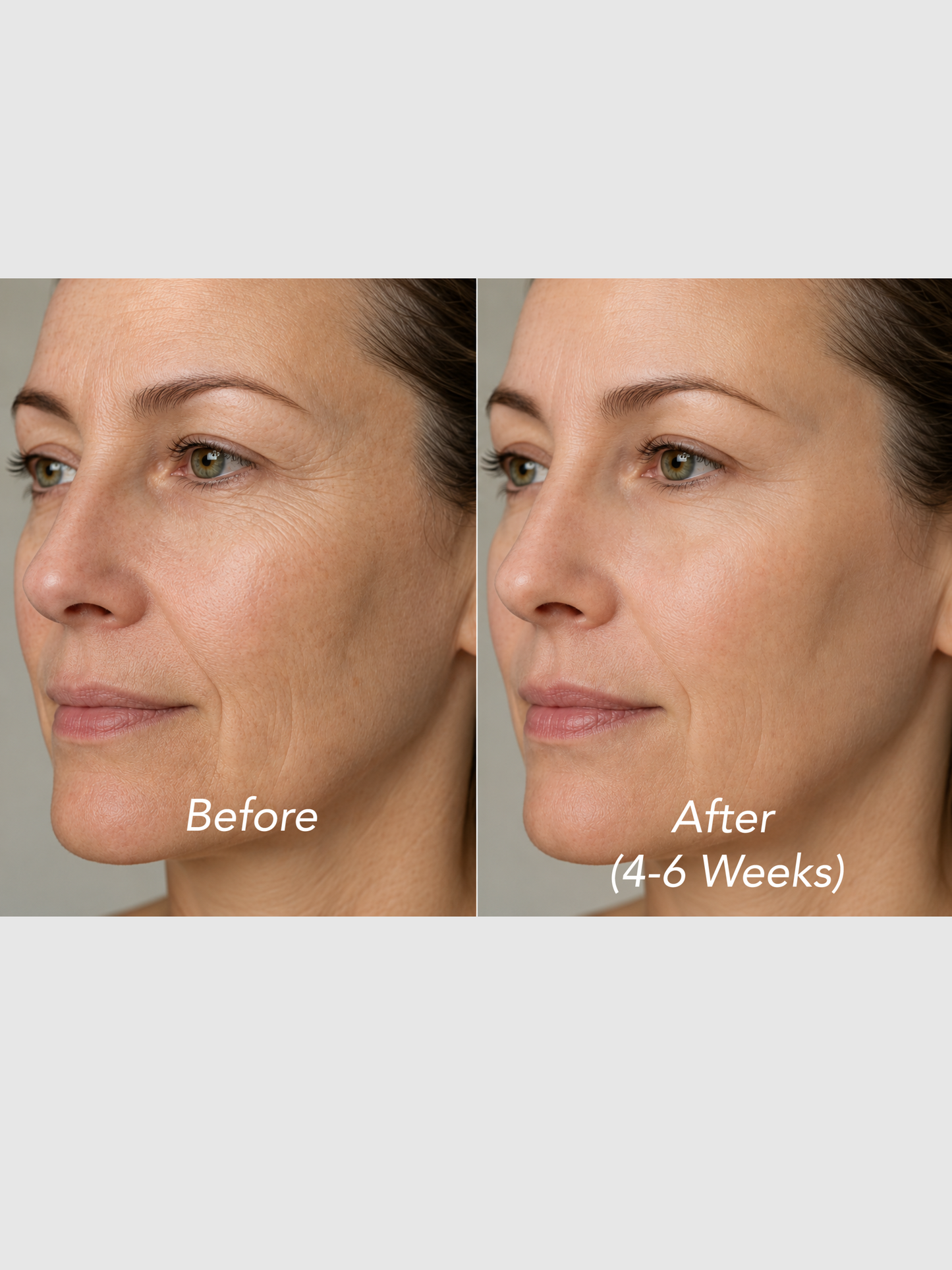 Ceramide Barrier Cream – Skin Repair & Deep Hydration